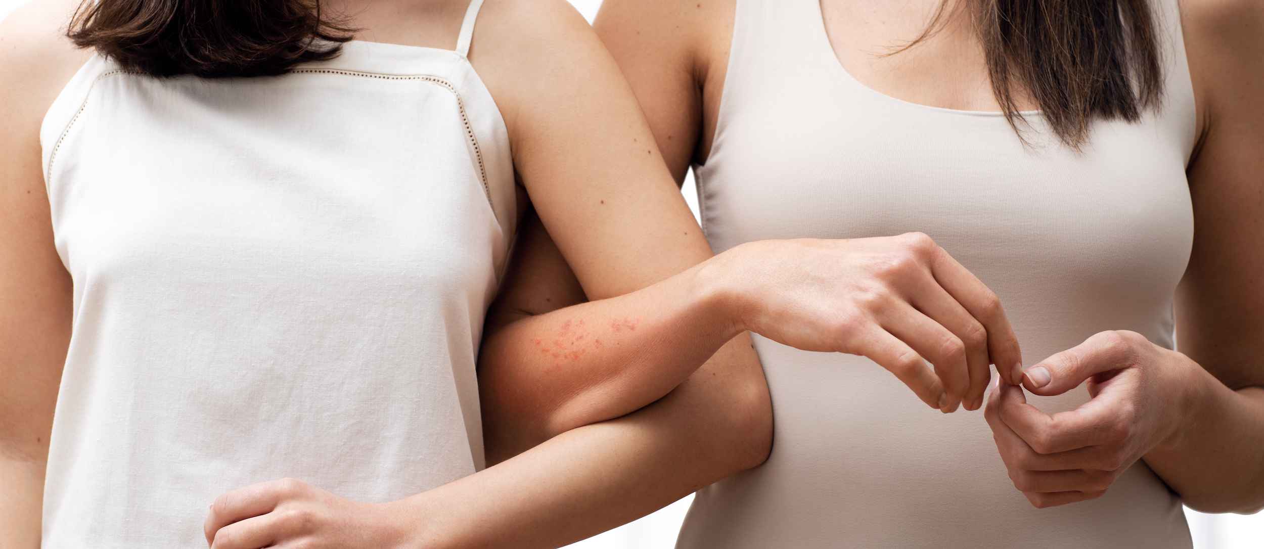 Derm Atopica