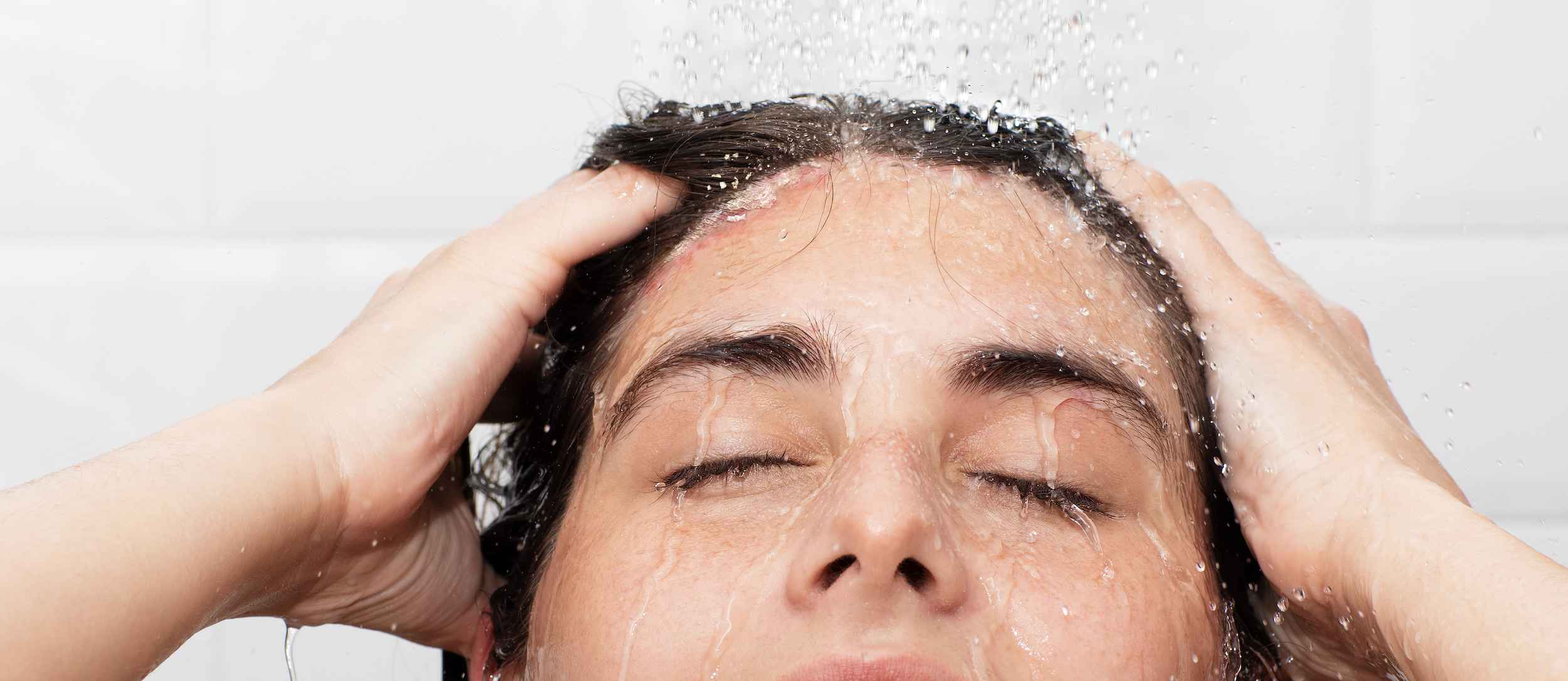 Derm Seborreica